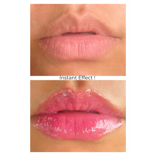 Gold Edition - Berry Pink